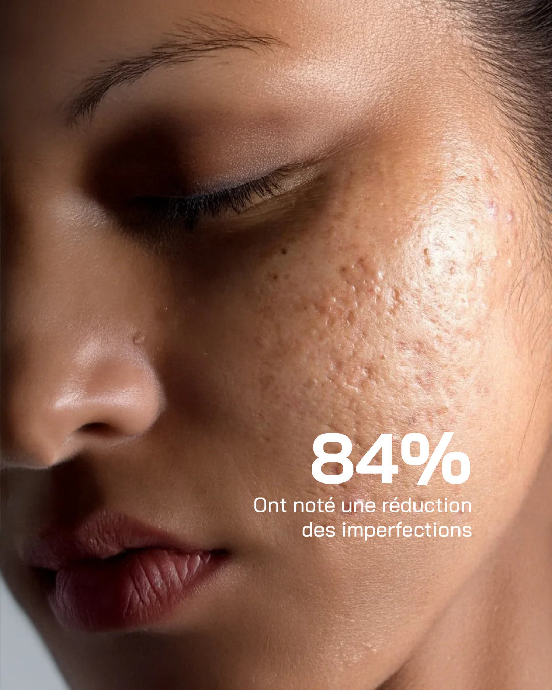 Touché Acide Hyaluronique + Niacinamide Peaux Sensibles – Image 5