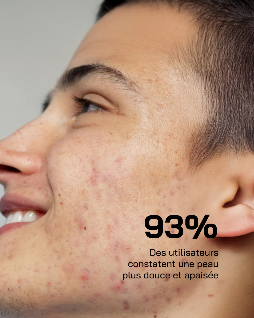Touché Acide Hyaluronique + Niacinamide Peaux Sensibles – Image 6