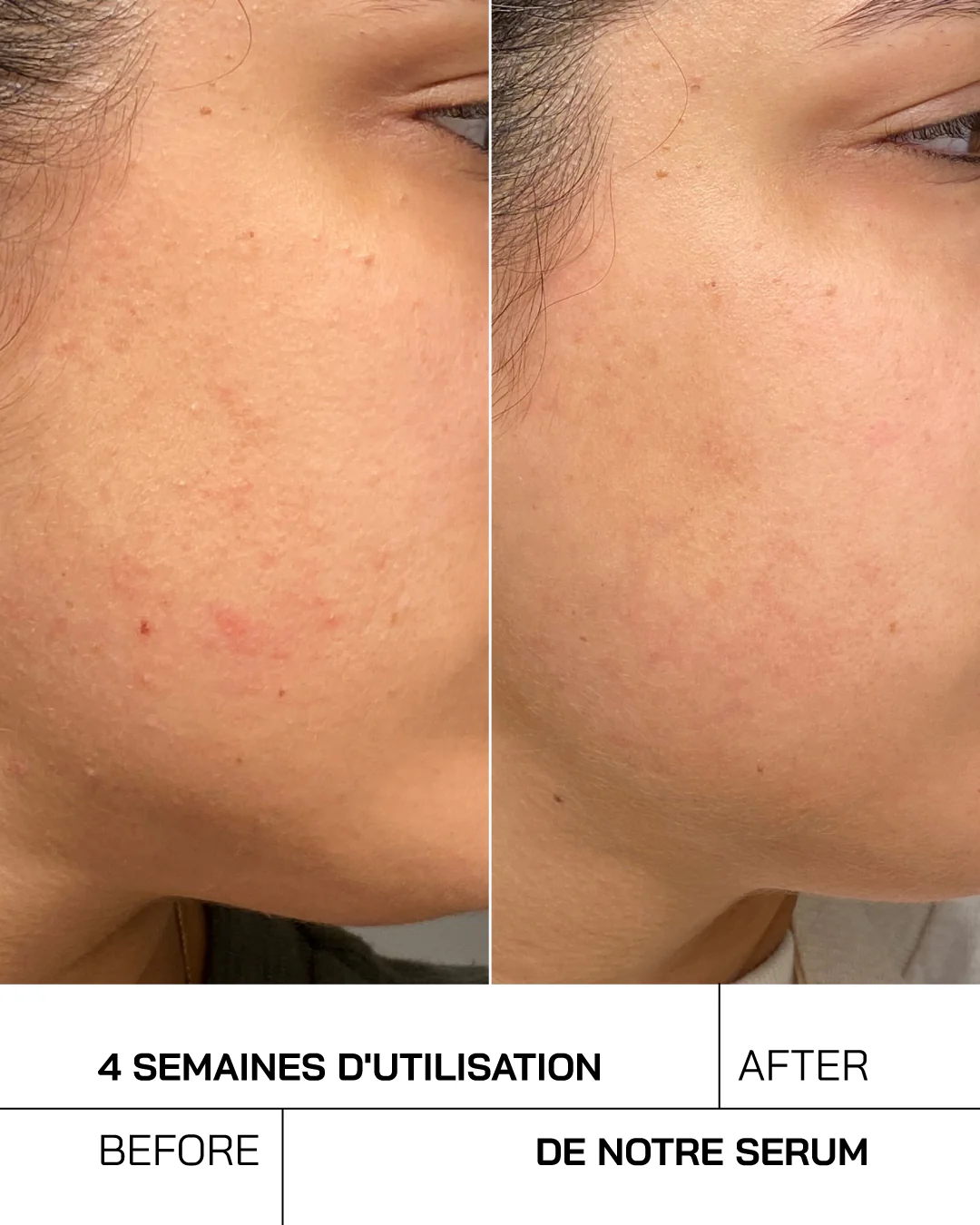 Touché Acide Hyaluronique + Niacinamide Peaux Sensibles – Image 8