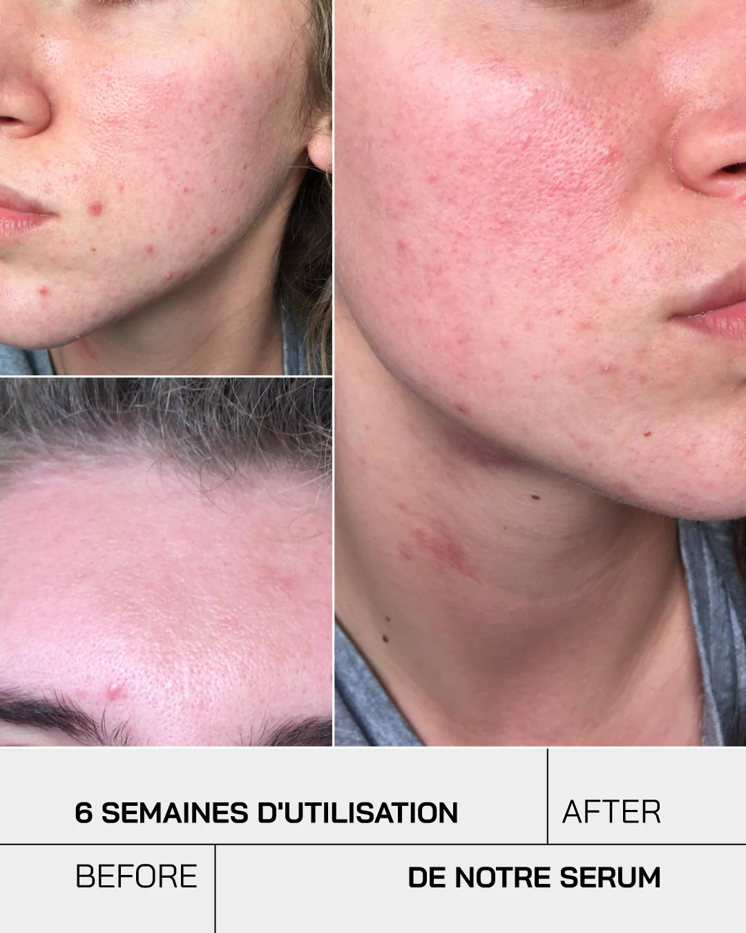 Touché Acide Hyaluronique + Niacinamide Peaux Sensibles – Image 9