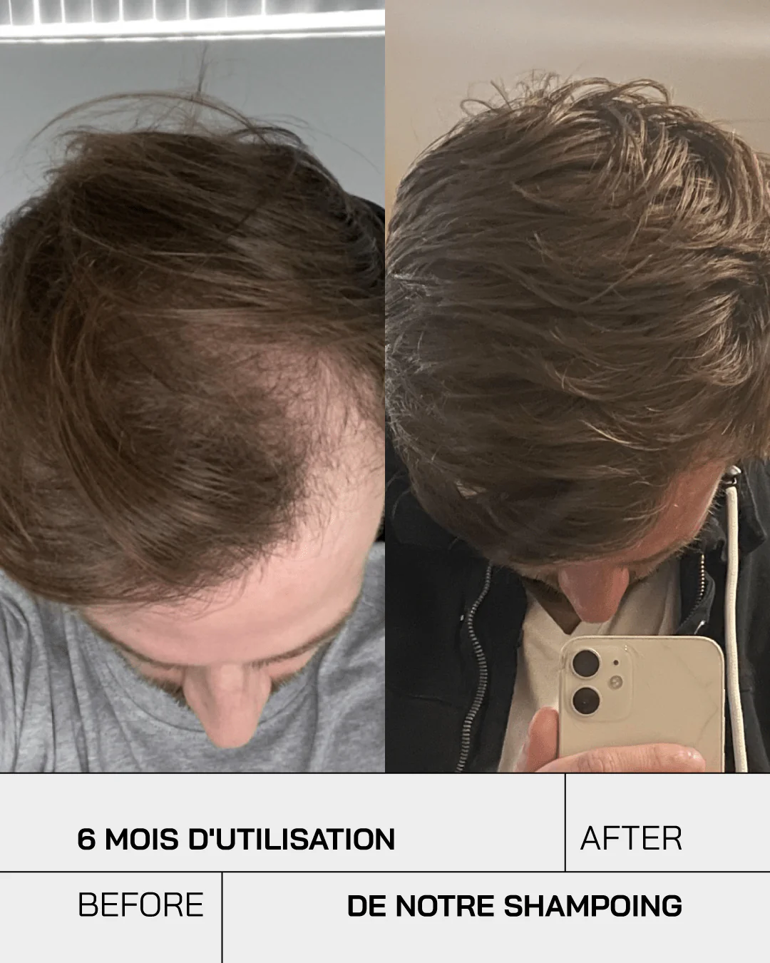 Touché Shampoing Anti Chute – Image 7