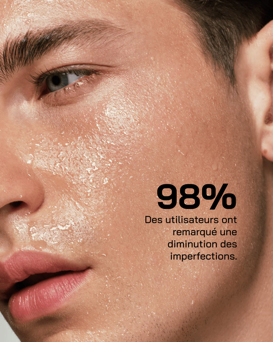 Touché Acide Salicylique – Image 10