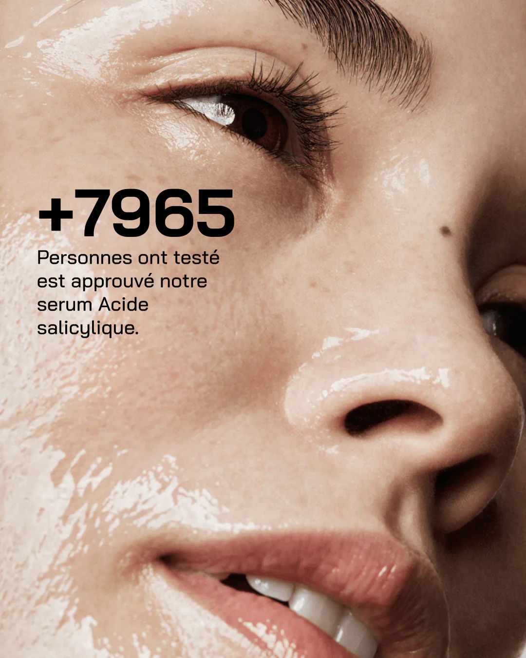 Touché Acide Salicylique – Image 11