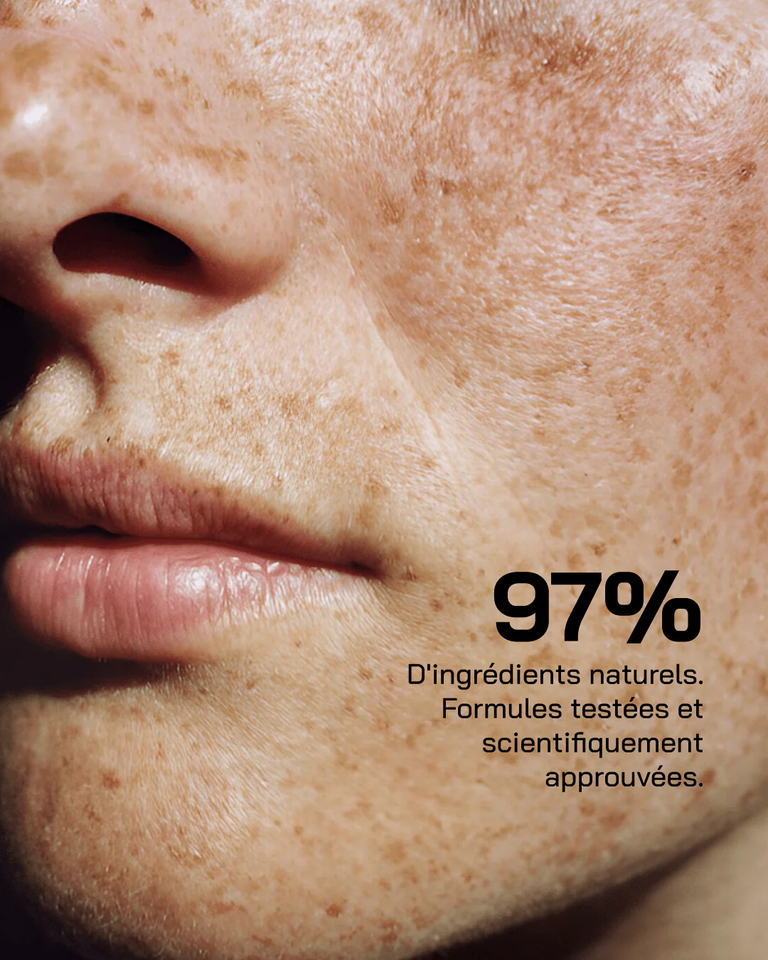 Touché Acide Salicylique – Image 12