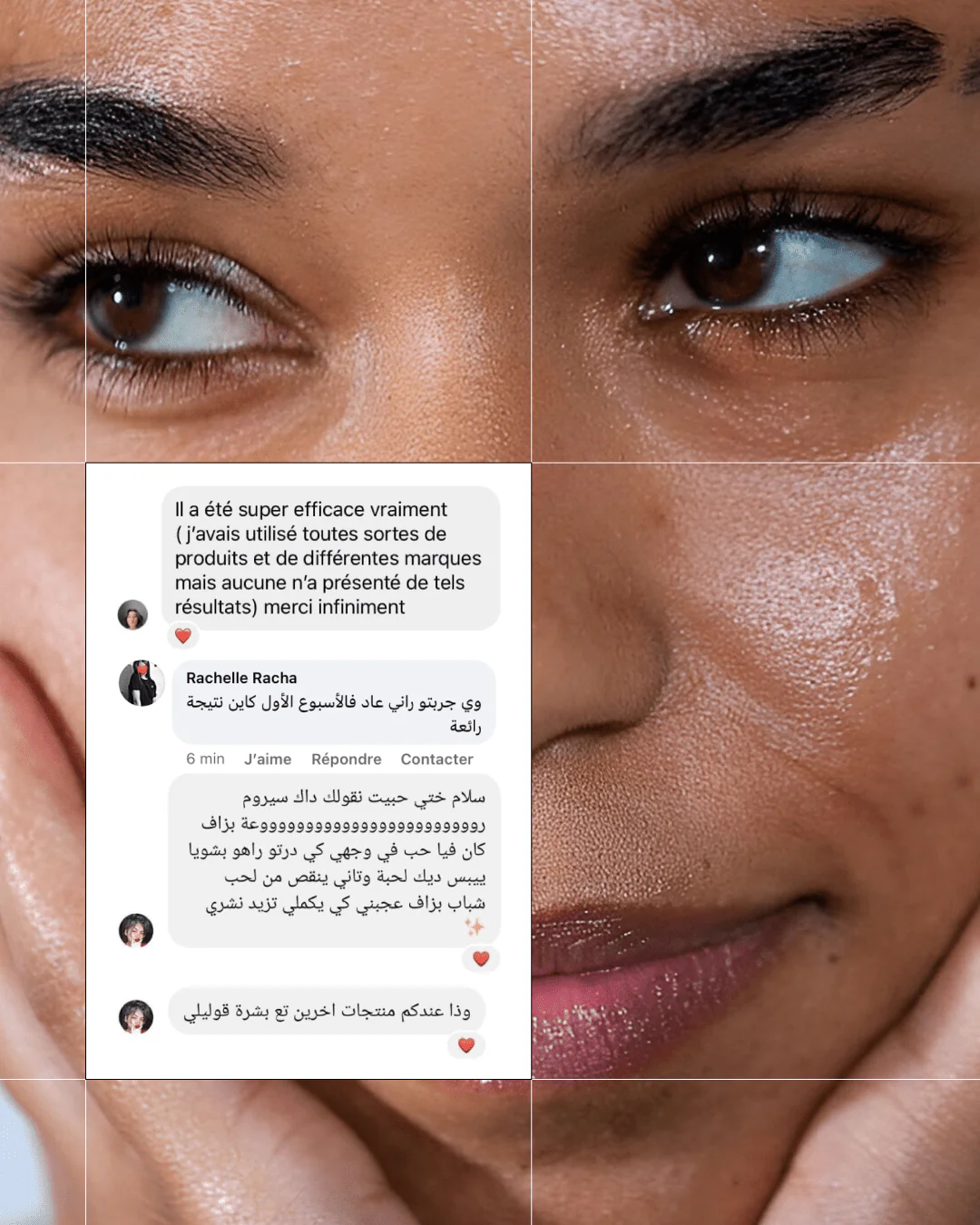 Touché Acide Salicylique – Image 13